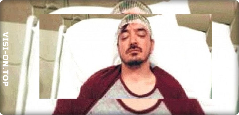 النجم التركي، أورهان أولمز، في المستشفى بعد حادث الاعتداء عليه من طرف جيرانه