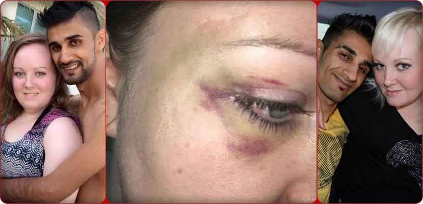 صورة للزوجة البريطانية مع رزوجها وآثار الاعتداء على وجهها